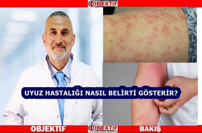 Salgın artıyor!