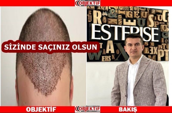 Uluslararası tercih edilen saç ekim merkezi: Esterise