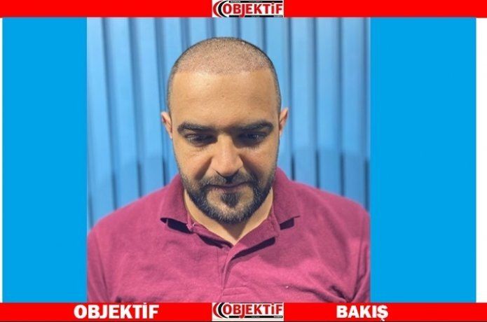 Kanada’dan gelip saç ekti