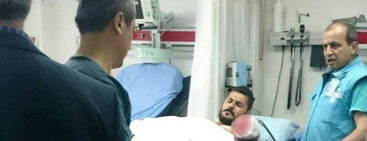 İşçinin makineye kapılan kolu koptu