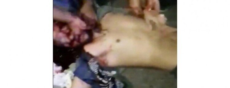 Motosiklet ile araba çarpıştı: 2’si ağır 3 yaralı