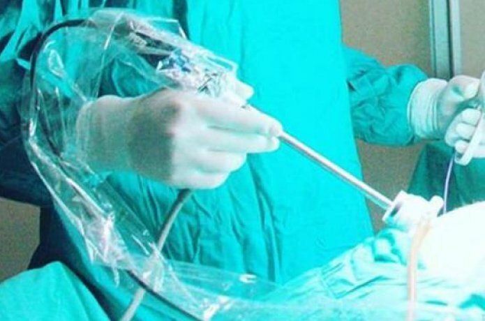 ‘’Dev kitle kapalı ameliyat ile çıkarıldı’’